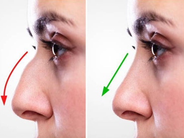 Plastic Surgery